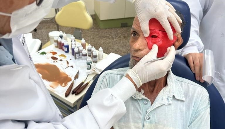 Projetos da UFPB reabilitam pacientes com deformidades faciais  em João Pessoa